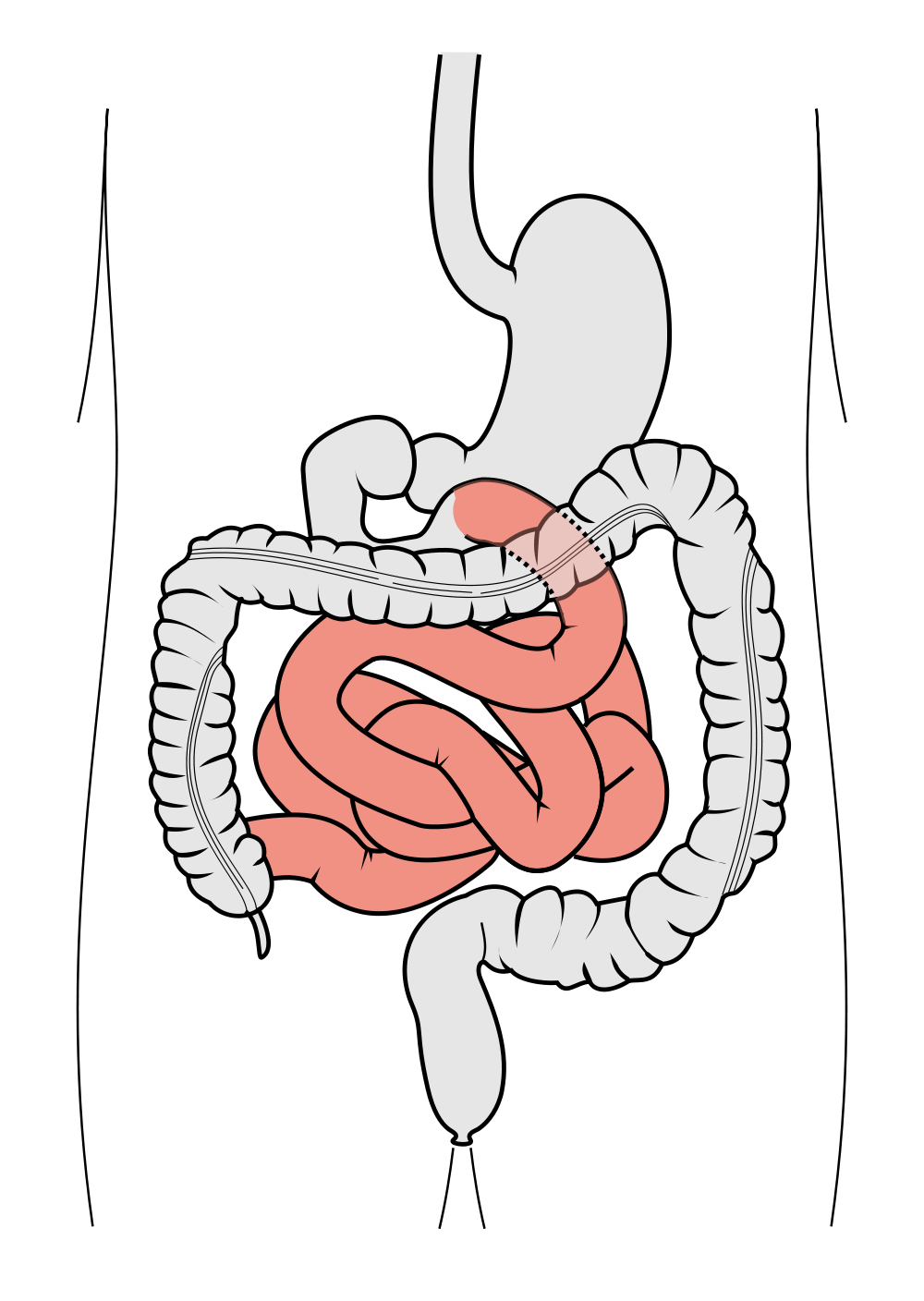 Intestino delgado